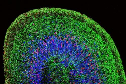 Microscopic image of a mini brain organoid generated from human induced pluripotent stem cells. 