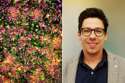 A side-by-side image with a microscopy image showing cell villages on the left and Michael Wells on the right.