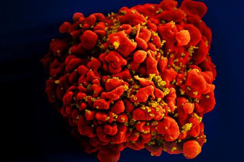 The improved therapy engineers the body’s immune response against HIV rather than waiting for the virus — or parts of the virus — to induce a response. (Image: A T cell infected with HIV.)