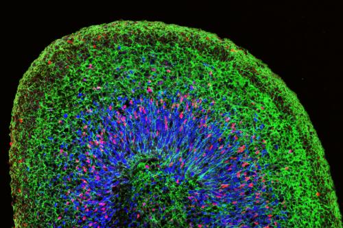 Microscopic image of a mini brain organoid, showing layered neural tissue and different groups of neural stem cells (in blue, red and magenta) giving rise to neurons (green).