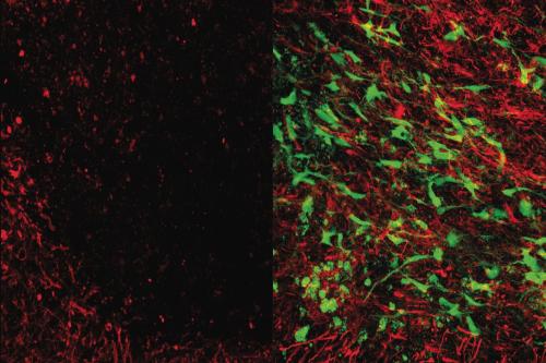Microscope images showing brain tissue that has been damaged by white matter stroke (left) and then repaired by the new glial cell therapy (right). Myelin (seen in red), is a substance that protects the connections between neurons and is lost due to white matter stroke. As seen at right, the glial cell therapy (green) restores lost myelin and improves connections in the brain. 