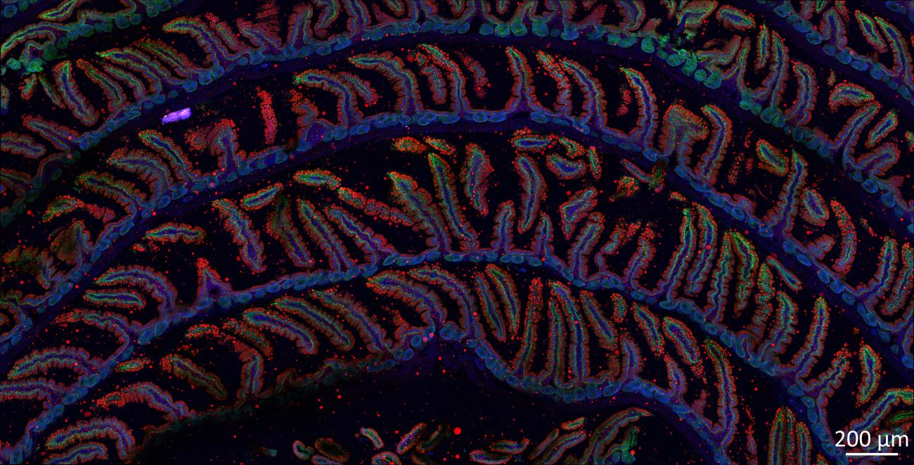 Striking microscopy image of intestine cells 