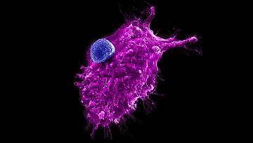 An engineered HSC-iNKT cell attacking a human tumor cell