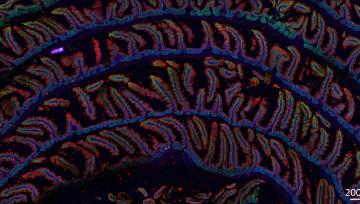 Striking microscopy image of intestine cells 