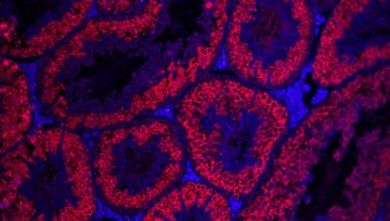 germ cells (red) in mouse seminiferous tubules