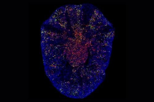 Fluorescent imaging of fibrotic kidney scar tissue